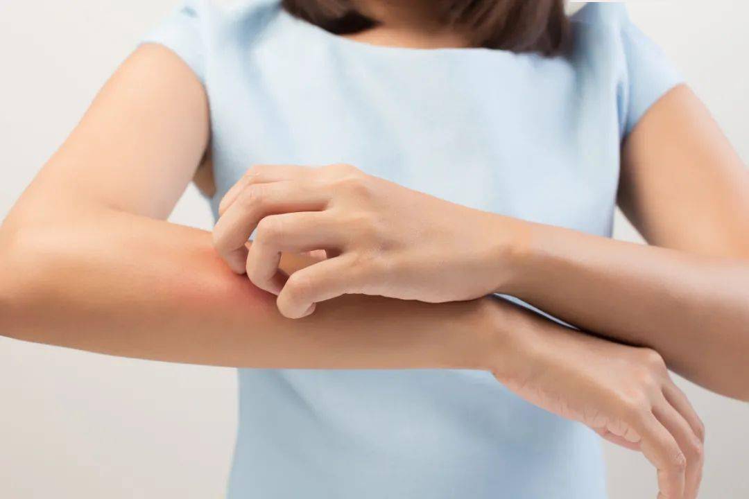 避开 肌肤破损部位 涂抹时要仔细 涂抹身体乳时也要注意避开肌肤损伤