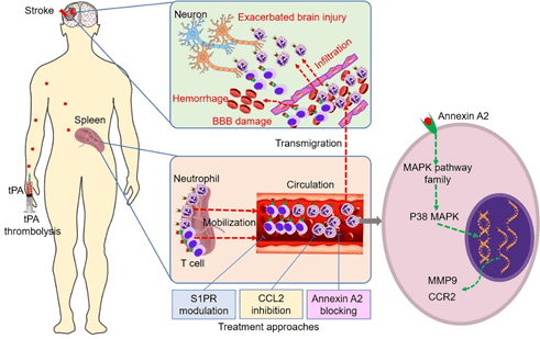 免疫|【医前沿】攻克脑卒中tPA溶栓出血转化和狭窄疗效时间窗的新希望