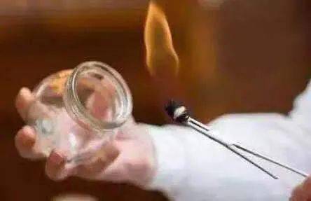 你所不知道的拔罐疗法——平衡火罐