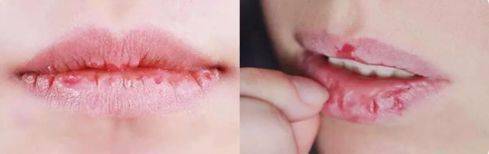 是一种|唇膜界的“唇纹小熨斗”！抹1次=10次润唇膏，抹出Q弹水嫩少女唇，是一种让男神心动的高级撩！
