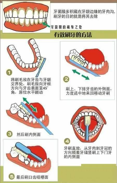 口腔知识宣传图大全看看哪个是你用的着的