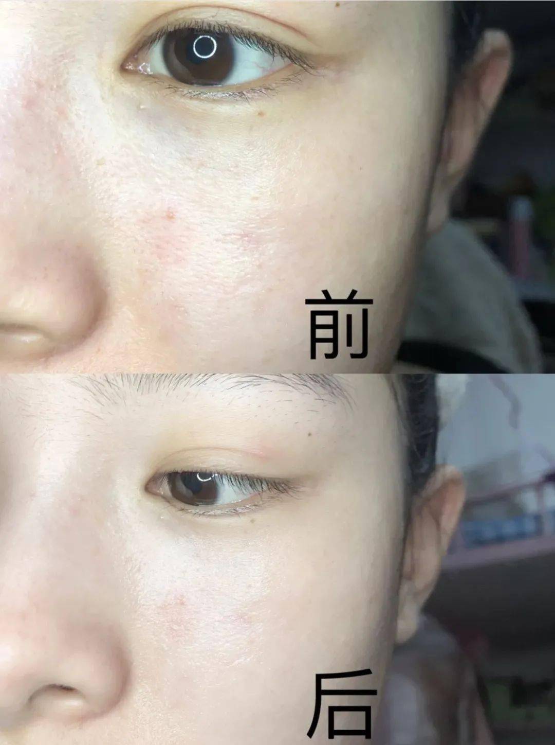 call|常年生活在0下20度！但这些极地女生的皮肤依然嫩到掐出水，都是这款芬兰国宝护肤品的功劳！李佳琦也在疯狂打call！