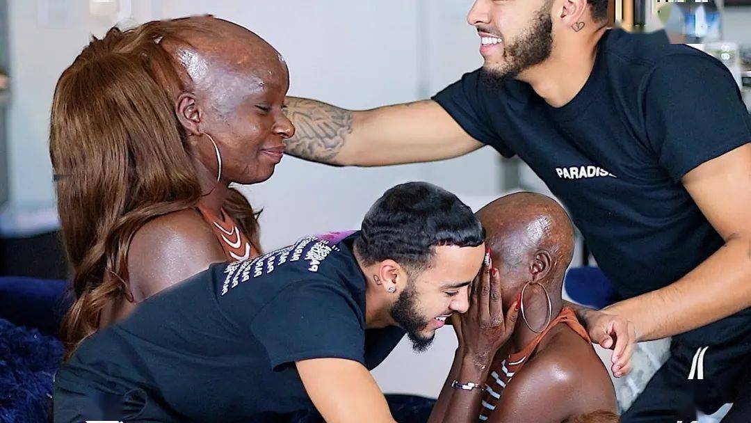 女童|非洲部落9岁毁容女童接受“换头术”，15年后现状曝光看哭网友：这才是顶级美人！