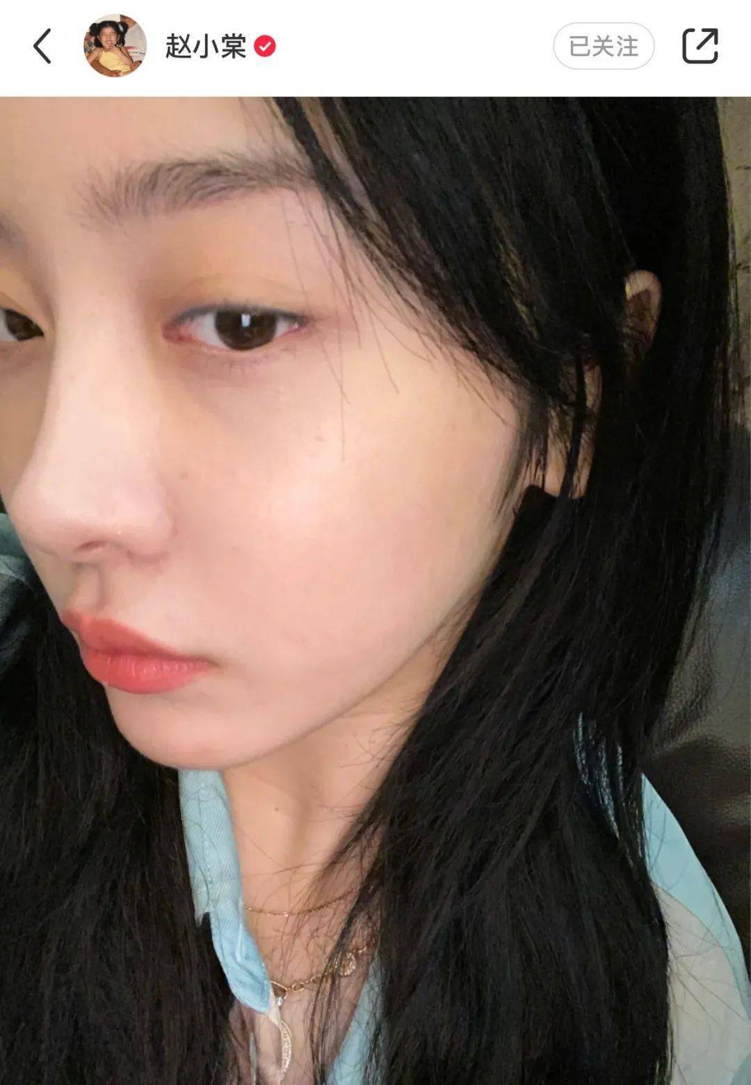肌肤|万万没想到，我在秋天晒黑了，赵小棠怎么没有？