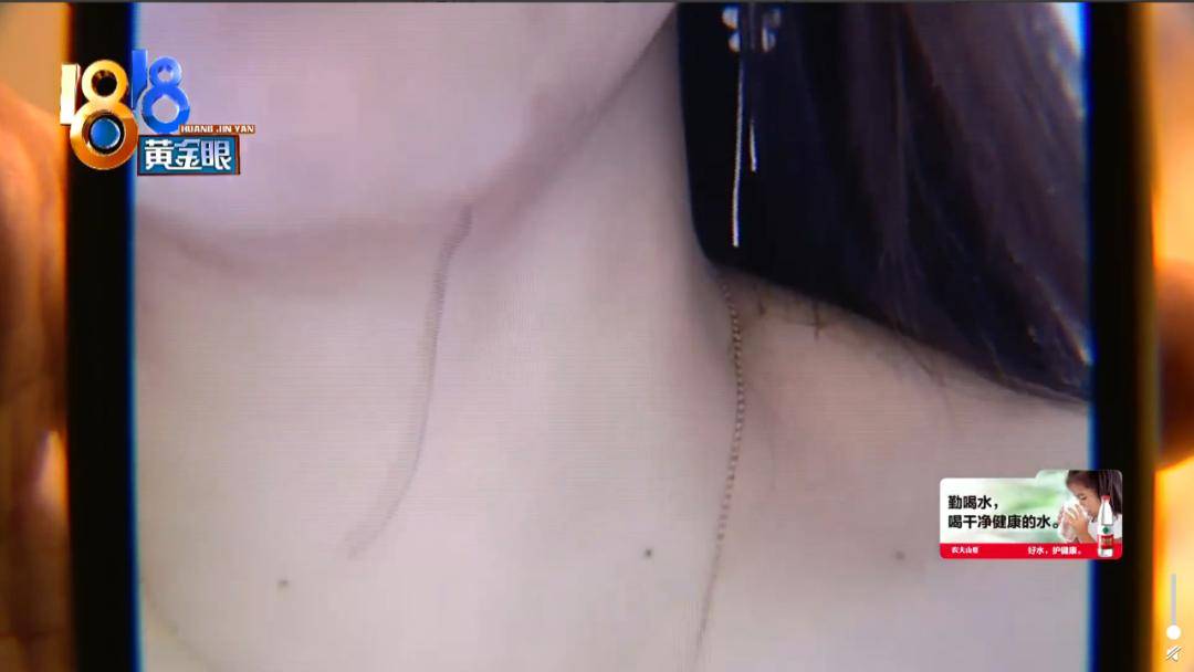 年轻人|年轻人做起医美来，到底有多拼？