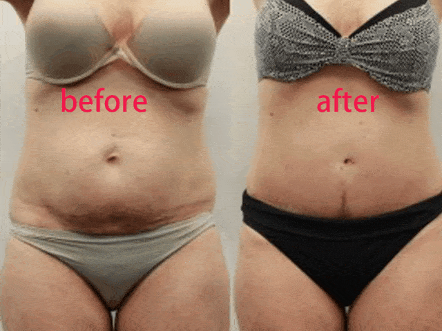 腰带|日本变态“收腰带”,25分钟等于卷腹368次!狂甩游泳圈,轻松get少女腰!