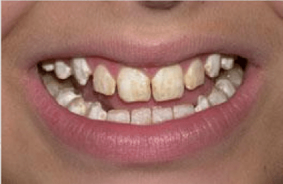 f80ce9a23c1f42069305409b792ee4c8.png