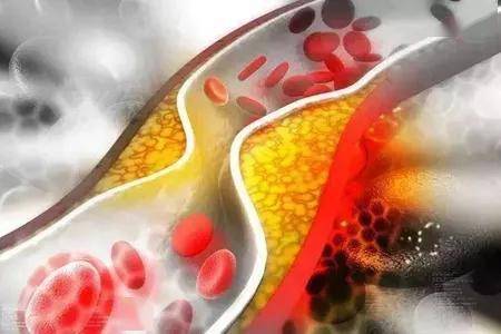 肾结石是属于肾功能不全吗 3fda0ec8933341e484ca6cf2d6e8de55.jpeg