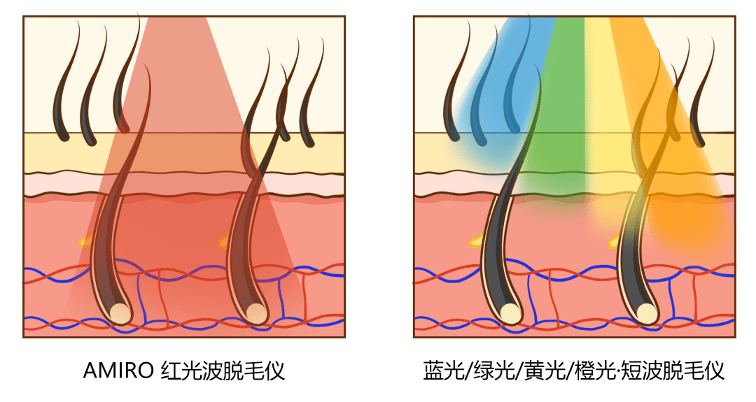 毛发|揭 秘 秋 冬 女 孩 「 身 体 の 小 心 机 」