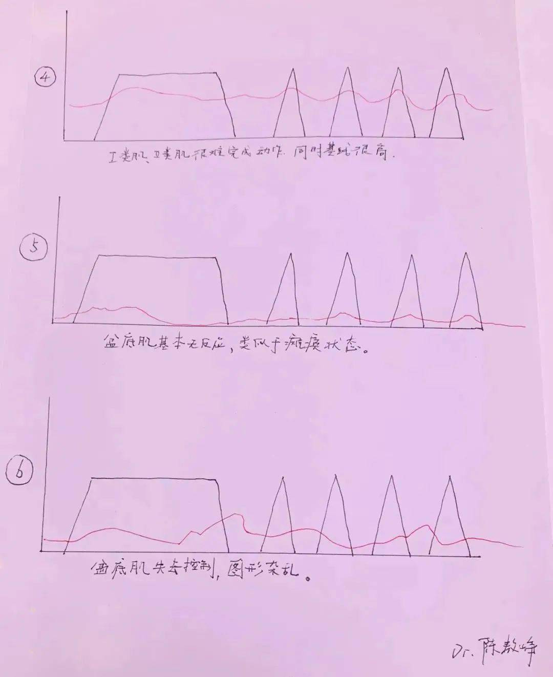 妇产科医生3000字精华教你10分钟掌握盆底自测方法