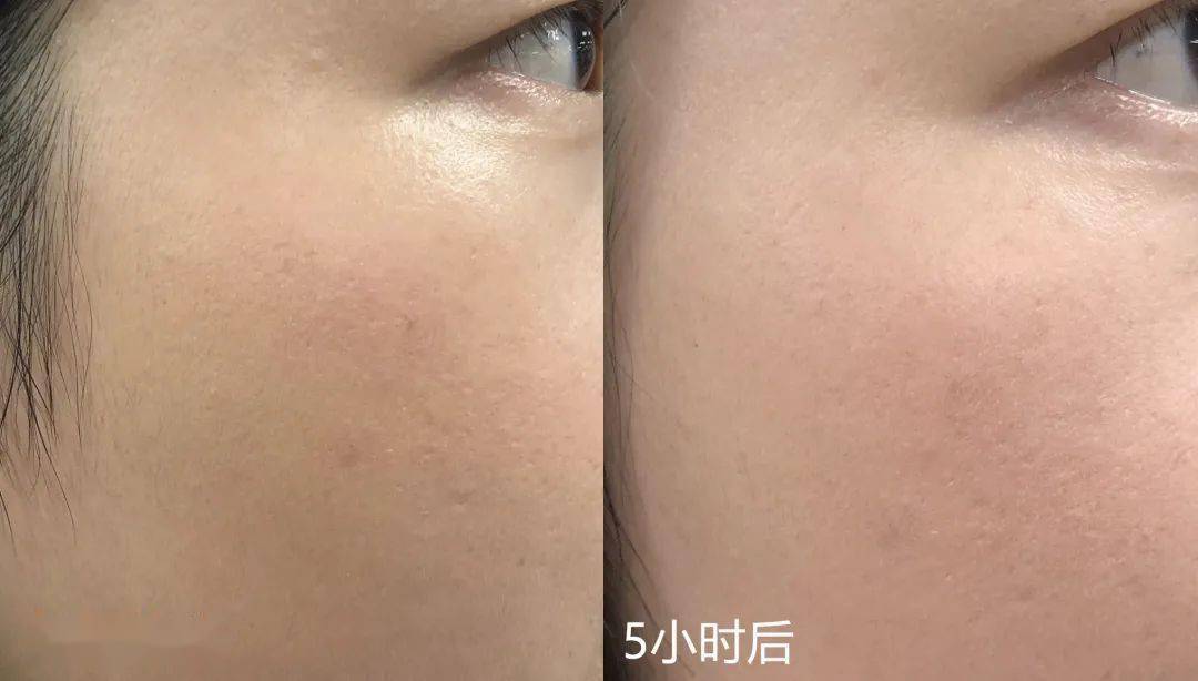 预售|200块也能化出百万化妆师同款底妆！3分钟让毛孔隐形，get粉嘟嘟的奶油肌！实在是太好看了~