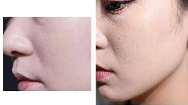 皮肤|毛戈平又放大招，“重返”20岁原来这么简单？