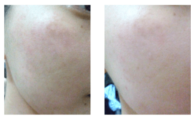 皮肤|可涂抹的“水光针”，一支8元相当于敷10片面膜，轻松抹出弹润少女肌！