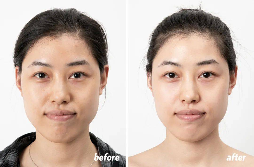 皮肤|狂吃火锅不长痘，这位影后太拉仇恨！