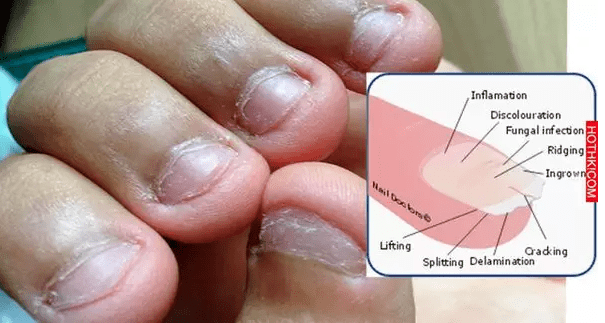 ta|十斤黑芝麻都比上2颗ta！风靡美国的这颗糖把头发越吃越密，皮肤也变好了，感觉年轻10多岁！