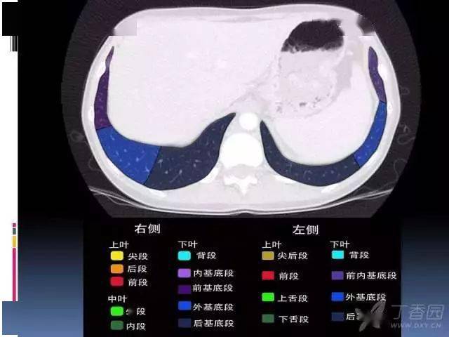 ct入门丨肺叶分段ct高清图谱