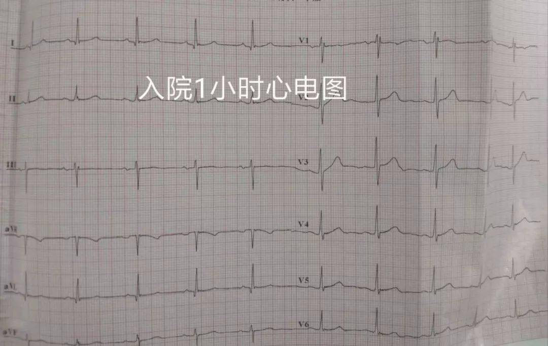 吃什么药降心率不降压 a295eb3d7d1d4b0d9021b58ed5ea6139.jpeg