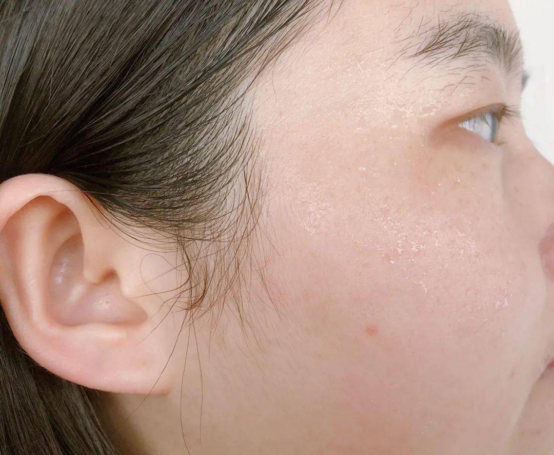 肌肤|嫩到掐出水！用一次比敷100片面膜还白润，10分钟感受女星同款水光肌！