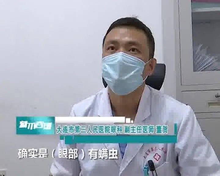 12岁男孩眼睛发红怕光,竟是眼上有螨虫?眼睛总不舒服别再不当回事了!