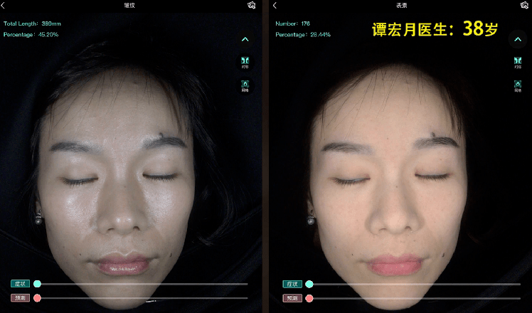 小土|黑黄皮逆袭！IU从“小土妹”到“白雪公主”，靠的竟然是它？！