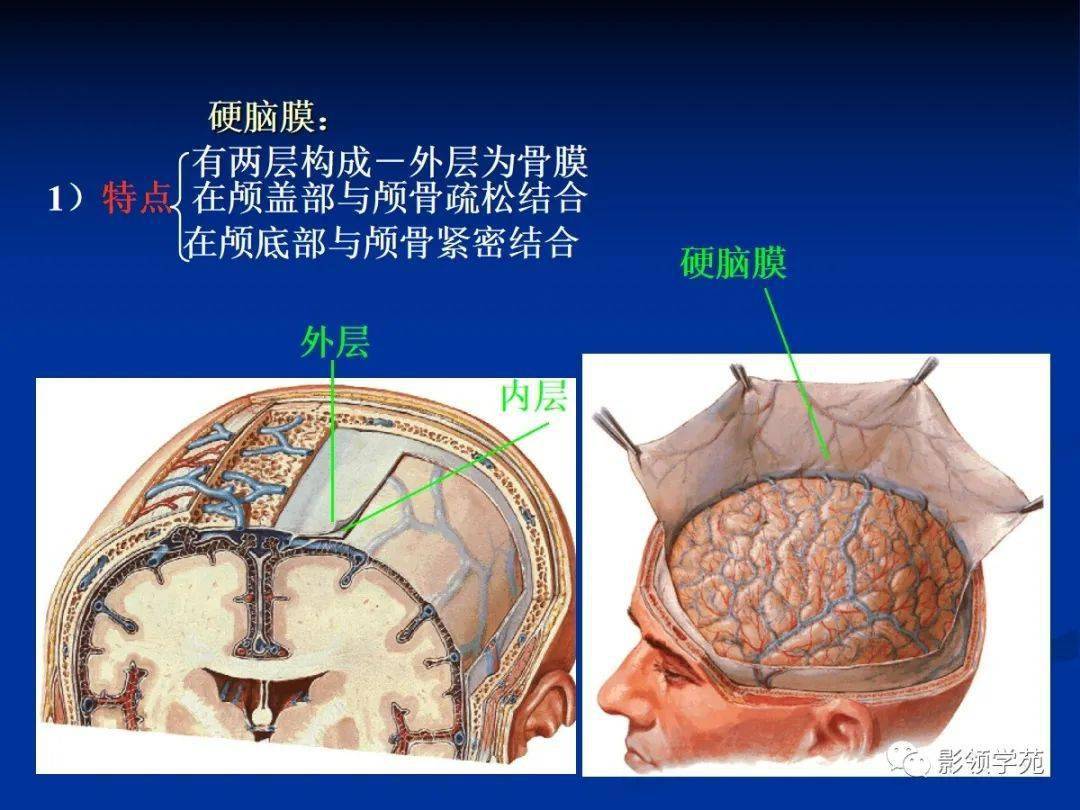 新鲜人体解剖实战精讲班  脑膜疾病的影像学诊断与鉴别诊断