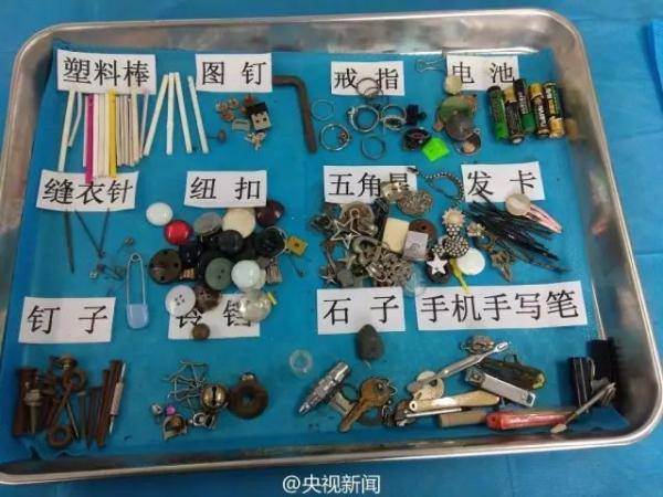 家长|家长一个月后才送医,结果…1岁男婴吞了8颗磁力珠