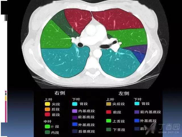 ct入门:肺叶分段,支气管,肺动脉 ct 图谱全在这