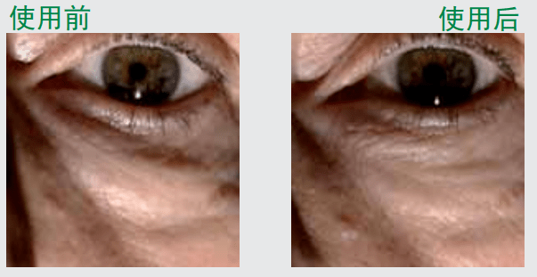 近照|曾经红极一时的“最美港姐”近照曝光，原来美人真的能被一个细节毁掉.......