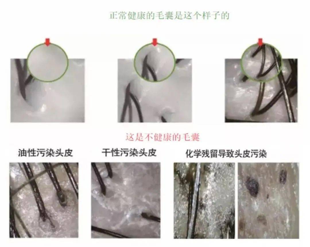 阿娇|这款被张歆艺、张馨予、阿娇都争着用的防脱洗发水，不仅固发，3天不洗头都不会油！