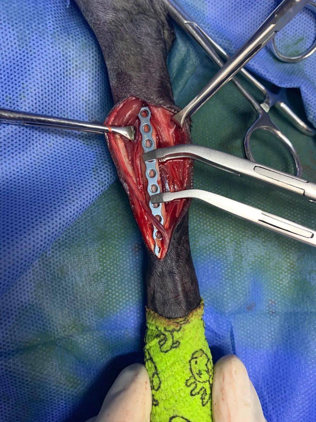 病例分享贵宾犬桡尺骨骨折prcl锁定骨板系统临床病例分享