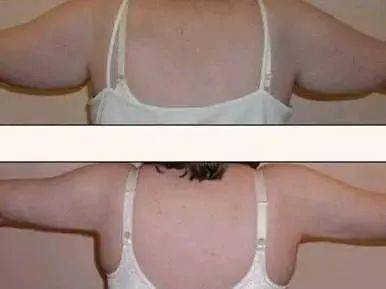 手臂|身体这个部位，男生怕它细，女生怕它粗.....