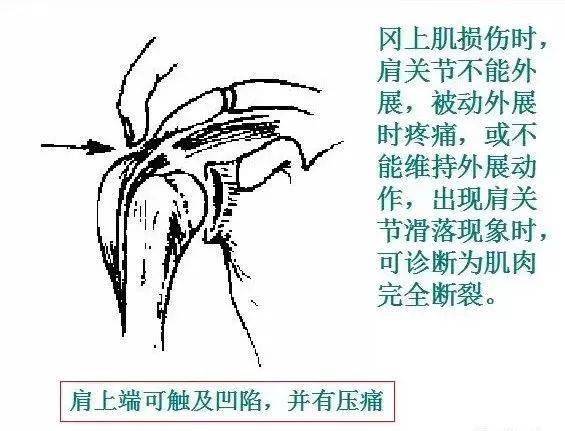 什么直若屈成语_成语故事简笔画(3)