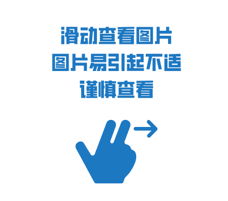 手术|四期腹膜转移胃癌患者还有手术机会吗？外科专家这样说