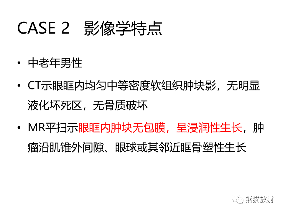 眼眶绿色瘤,淋巴瘤解剖丨颅面颈部(颅面骨,眼眶,腮腺,等)返回搜狐