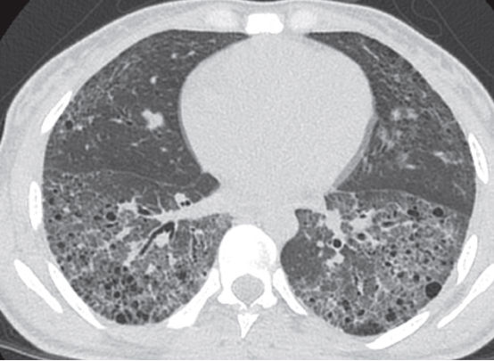 �����Է����Բ���ļ������