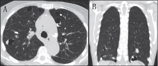 �����Է����Բ���ļ������