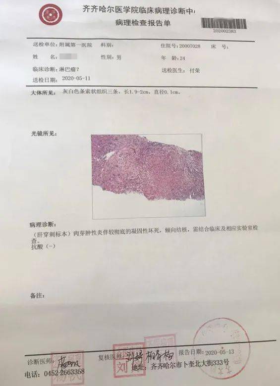 医学前沿得了肿瘤为什么要做穿刺齐医附属第一医院同轴活检技术来解答