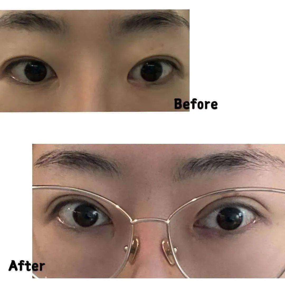 双眼皮|原来大家都是这么“脱单”的……