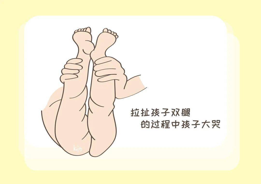 宝宝的大腿纹为啥不对称?这是什么情况?带你一起了解下