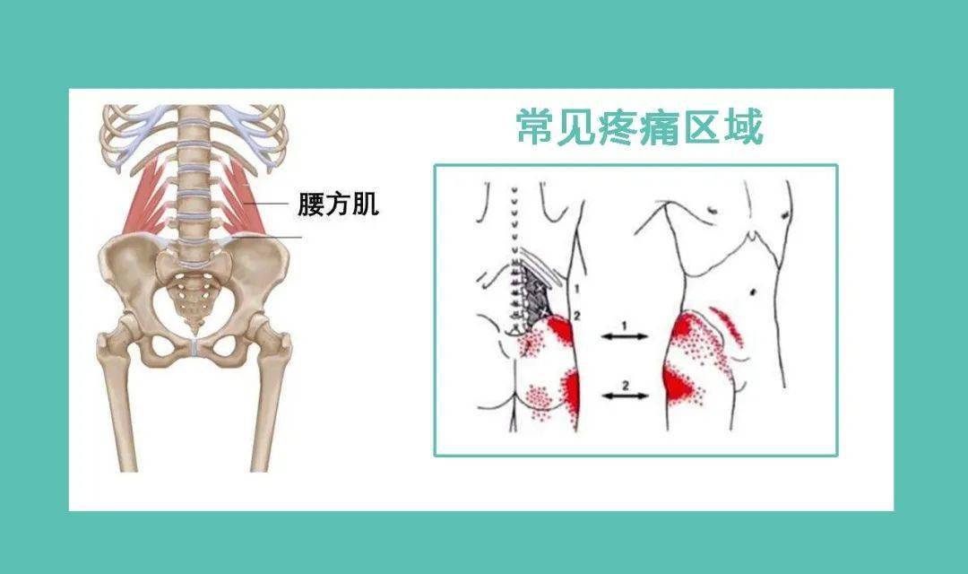 骨盆人口右倾斜经_骨盆倾斜图片(2)