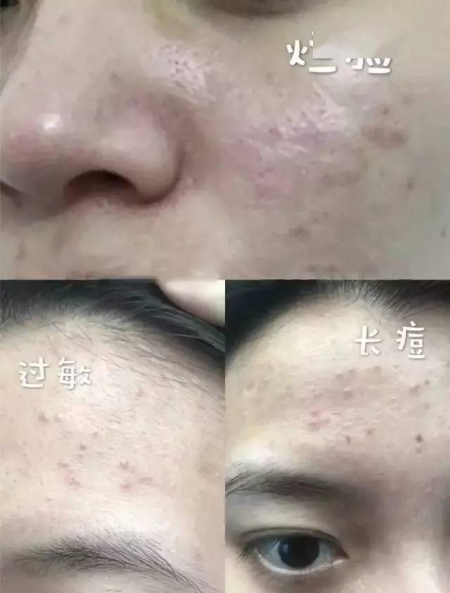 d85067f21d6546da96e1a5810d8bb2af.jpeg