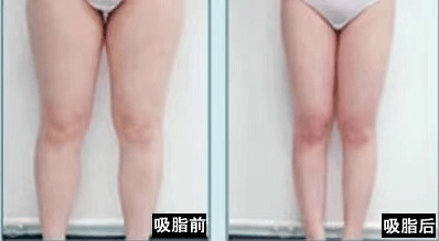 597634adf4384dbbaabfd65b6f3b2316.png