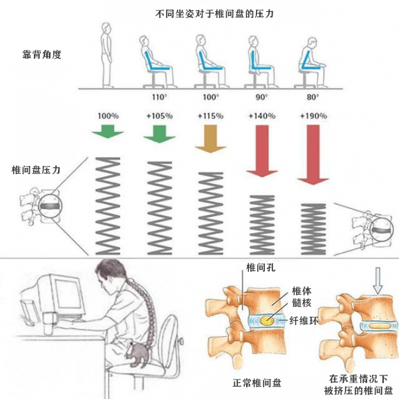 日常生活中的不良姿势  是腰椎间盘突出的慢性推进器 不同的坐姿对椎
