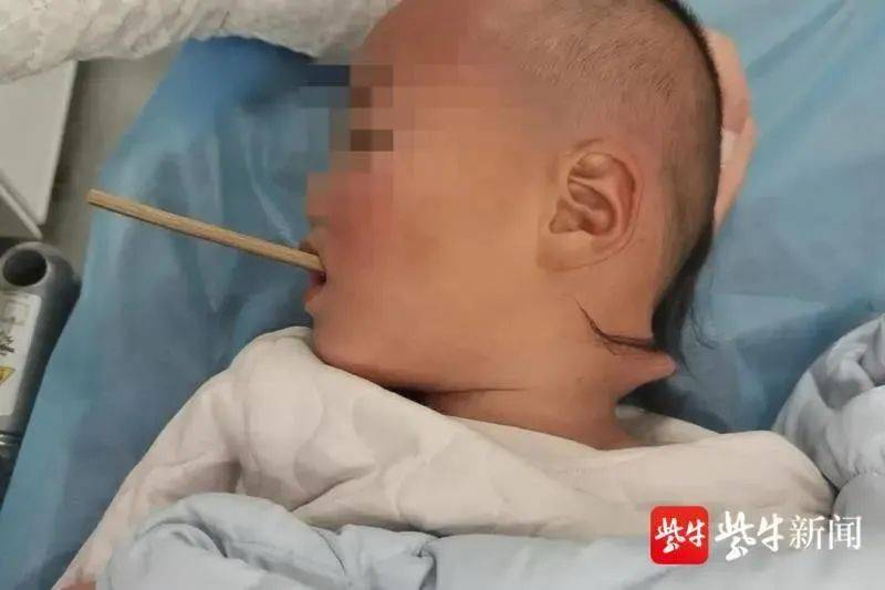 婴儿抬头脖子歪向一边怎么纠正 888a97f9bb7a438986f9aef836e30d4d.jpeg