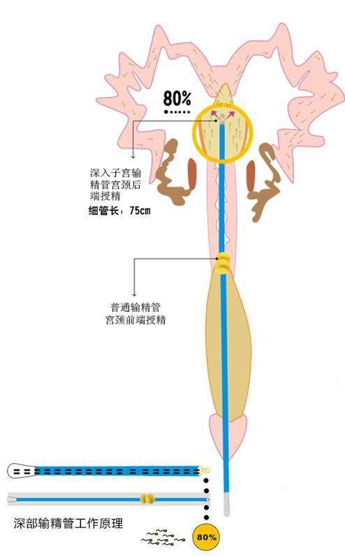 探秘猪深部输精技术真如传说这么神