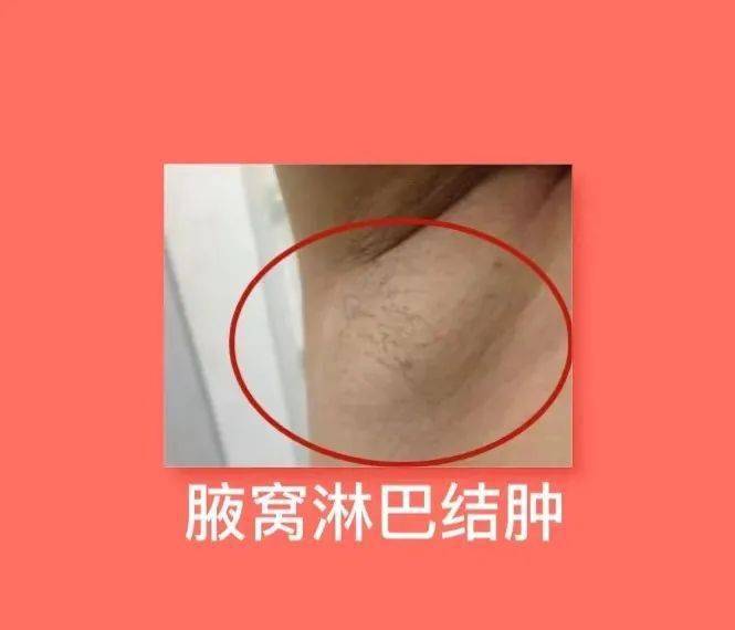 所有女人都该学会!_乳腺