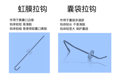 囊袋张力环 ctr囊袋张力环是由pmma材料制成,呈c形开放环形构型,它