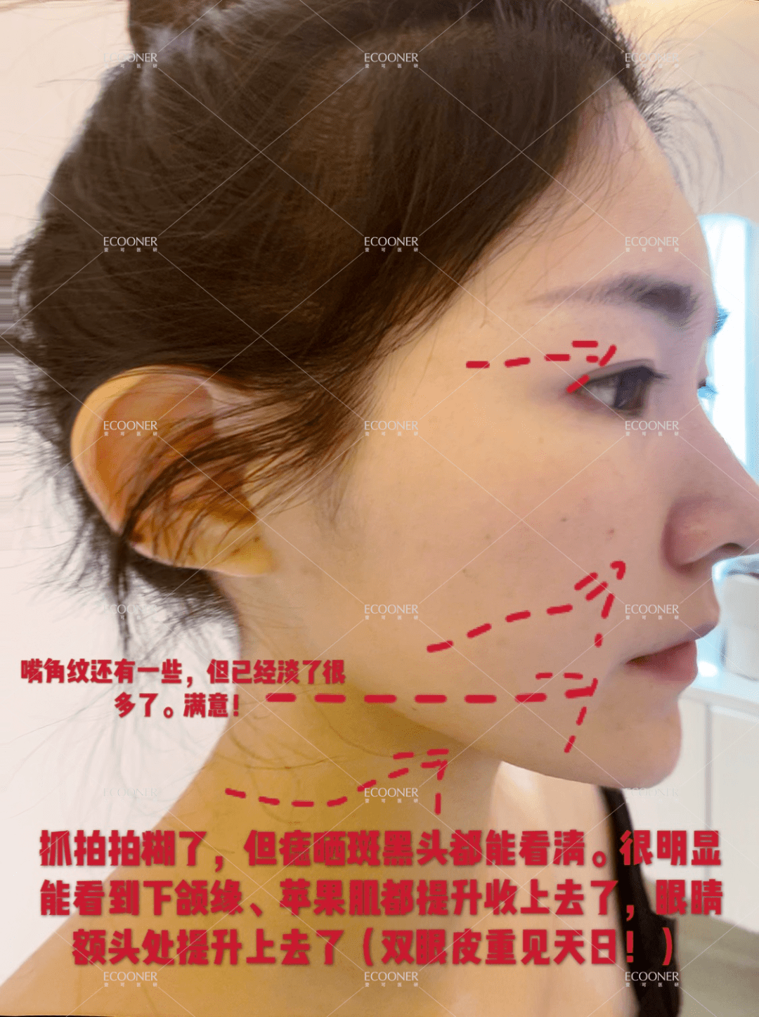 50aaaef63dea46dca23dd6e113c08512.png