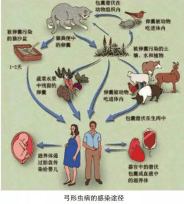 弓形虫病感染方式有两种,一种先天性感染,一种后天获得性弓形虫病.