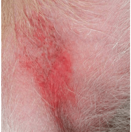 4 一只因异位性皮炎而出现腋窝红斑的狗 7)血小板减少性瘀斑在毛发
